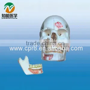 The Skull (10 Parts) BIX - L1013 thumbnail-1