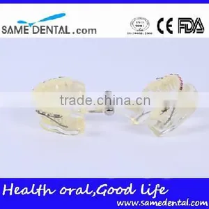 High Quality Dental Transparent Orthodontic Models School Teaching Demonstration thumbnail-2