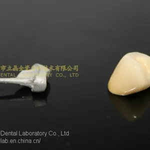 Full Metal Post Core, Full Ceramic Post Core, Richmond Crown, Cast Metal Crown, Dental Prostheses, Laboratorio Dental, Dental Laboratory, Dentallabor, LJ Dental Lab China thumbnail-4