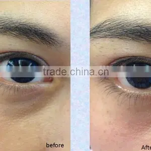 Salon Used Facial Equipment for Sale thumbnail-5