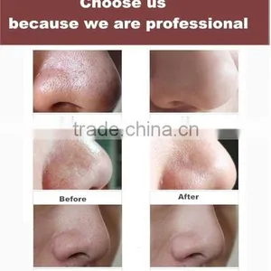 Easy and Simple to Handle Microdermabrasion Machine Facial Machine Diamond Microdermabrasion Beauty Equipment thumbnail-4