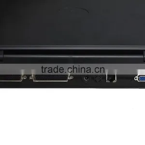 100% Guarantee CE Approved Laptop Portable Ultrasound Scanner 4 Optional Probes Ultrasound System 18 Month Warranty thumbnail-4