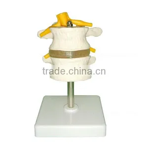 Human Body Anatomy Spine Model Lumbar Vertebra thumbnail-2
