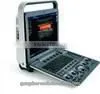 pc Based Ultrasound Scanner Portable Ultrasound Scanner Usb Ultrasound Scanner thumbnail-4