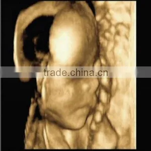 MQ Brand Good Quality Multi-function Medical pa Film thumbnail-1