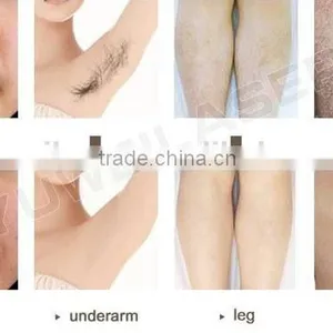Professional Shr Ipl Hair Removal System Machine in Hot Sale thumbnail-6