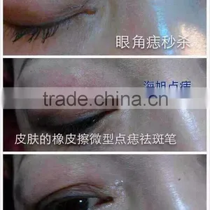 Spot Removal Machine , Freckle Removal Machine $260/pcs ,without Shipping thumbnail-4