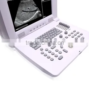 OB/GYN CE FDA Compact Multi-purpose Portable Doppler Ultrasound Scan thumbnail-3