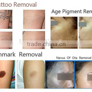 Chinese Apolo ISO CE Approved Beauty Machine Top Tattoo Machine thumbnail-5