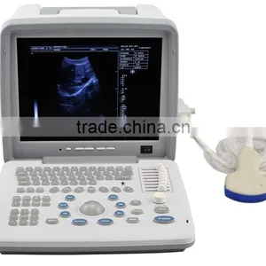 12 Inch Portable Veterinary Ultrasound Scanner With Convex Probe for Vet Animal 18 Months Warranty thumbnail-2