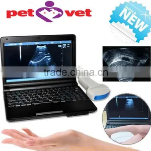 10 Inch Laptop Veterinary / Vet Ultrasound Scanner With 3.5MHz Convex Probe for Equine, Bovine, Swine, Sheep, Cat, Dog thumbnail-1
