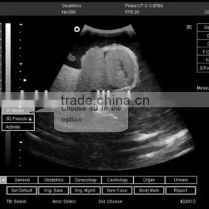 CE Approved Notebook Ultrasound Scanner With 3.5Mhz Multi-frequency Convex Probe RUS-9000E2 thumbnail-5