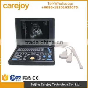 CE&ISO 10.4 Inch LCD Laptop Ultrasonic Machine PC System 3D Ultrasound Scanner With 3.5Mhz Convex Probe 7.5MHz Linear Probe thumbnail-1