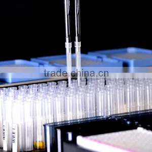 Automatic Elisa Laboratory Clinical Analyzer thumbnail-1
