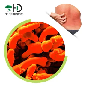 High-Potency Freeze-dried Probiotics Bacillus Probiotic Powder Bifidobacterium Breve Boosts Digestive & Immune Health thumbnail-1