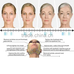 High Intensity Focused Ultrasound Hifu/ Hifu Anti-wrinkle With Amazing Effect thumbnail-2