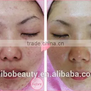 Best Dermabrasion Peeling Machine for Reduce Oily Skin Microderbrasion Peeling Machine thumbnail-6