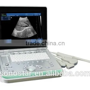 SS-9 PC Based Laptop Ultrasound B Scanner thumbnail-3