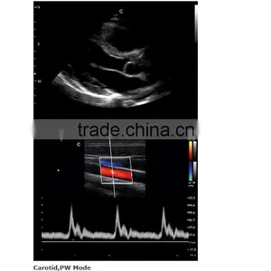 2016 New Portable Color Doppler(Optional 4D) for Cardiac Use thumbnail-3