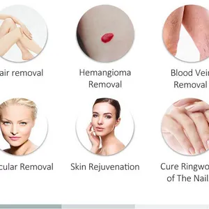 Laser 755 1064nm Dual Waves Alex Alexandrite Laser Hair Removal Machine Price 130J Max Energy Pigmented Removal Laser thumbnail-6