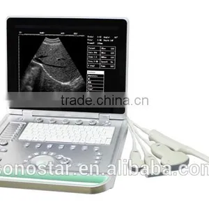SS-7 Laptop Ultrasound Scanner thumbnail-4