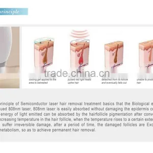 1-10HZ Newest 808nm Diode Laser Face Hair Removal Machine/810nm Portable Laser thumbnail-3