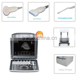 CE Approved Portable Chison USB Ultrasound Scanner With 3.5Mhz Multi-frequency Convex Probe ECO1 thumbnail-1