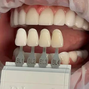 Dental Clip On Veneers, Snap On Veneers, Smile Veneers, Laboratoire Dentaire, Dentallabor,Dental Lab thumbnail-3