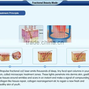 Most Advanced High Quality Beauty Equipment 10600 nm Laser Co2 Surgical Laser With USA Tube thumbnail-4