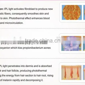 Hair Removal Machine for Women in Laser Beauty thumbnail-4