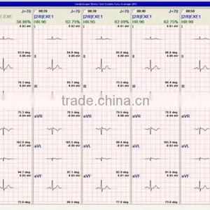 New Wireless Wifi ECG Stress Test System Cardiac Analysis With ST Software Kit+Trolley+ Treadmill thumbnail-5