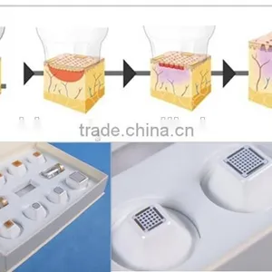 Hot Sale Portable Home-use RF 9D Thermacool Skin Resurfacing and RF Thermacool Effectively Machine thumbnail-6