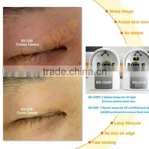 Skin Analyzer Type Skin and Hair Analysis Machine thumbnail-4