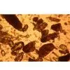 Common Alpha Plaster thumbnail-1