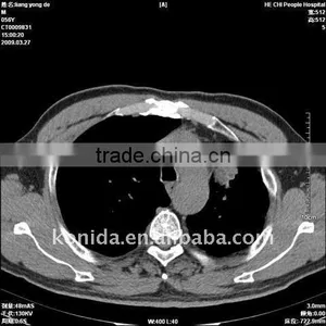 Women Hot Sex Images, X-ray Medical Thermal Films Compatible With Fuji Cr,diagnostic X-ray Equipment thumbnail-1