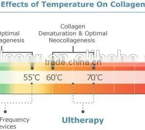 High Intensity Focused Ultrasound Hifu/ Hifu Anti-wrinkle With Amazing Effect thumbnail-3
