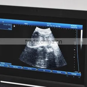 CE Ultrasonic System PC Platform 10.4 Inch Laptop Ultrasound Scanner / Machine With 3.5Mhz Convex Probe Li-ion Battery thumbnail-5