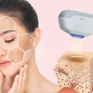 Hot Sale Dual Handpiece E-light IPL Super HR Hair Removal DPL Pigment Removal DPL Machine thumbnail-5