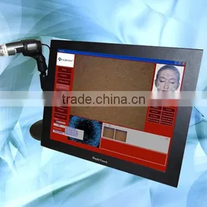 Companies Looking for Representative New Product Hair Analysis System thumbnail-1