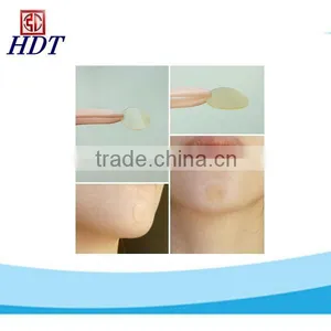 Hydrocolloid Adhesive Patch for Acne thumbnail-1
