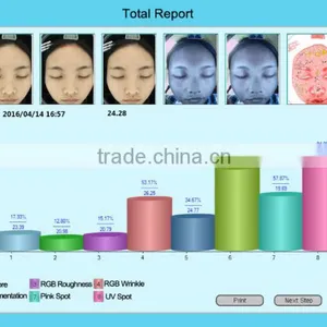 Skin Acne Spot Wrinkle Pore Moisture Skin Color Skin Sensitivity Facial Analyzer 3D Scanner thumbnail-3