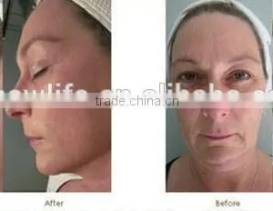 NL-RFC201 Portable Korea RF Facial And Body Tighten Beauty Equipment/Korea RF Facial And Body Tighten Beauty Equipment thumbnail-5