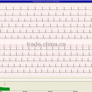 StressTest ECG System With PC Software Holter Algorithm for Heart Rate Triggering Treadmill thumbnail-6