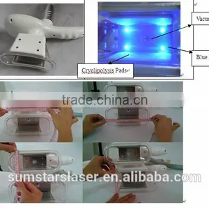 2015 New Design Slimming Machine/weight Loss Machine/ Cavitation Slimming Machine Factory Direct Sale thumbnail-6