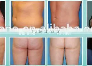 We Need Distributors 4 Handles OSANO Body Shape Vaser Liposuction Machine For Sale thumbnail-6