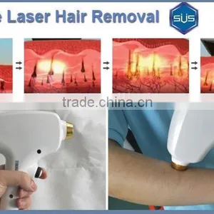 Latest Technology 808nm Diode Laser Professional Hair Removal Machine thumbnail-5