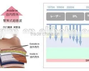 2016 GLM HOT SALE!hifu Machine/ultrasound Hifu For Wrinkle Chest Shaping Removal /F-029 Hifu Face Lift For Sell 1.0-10mm thumbnail-4