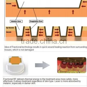 New Style Mini Bipolar Radio Frequency Wrinkle Removal Machine With Microneedle and Fractional Heads thumbnail-4