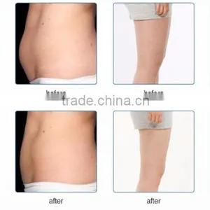 CoolPlas SCV-102 3 Cryo Applicators Best Effect Cryo Fat Freezing Machine For Sale thumbnail-5
