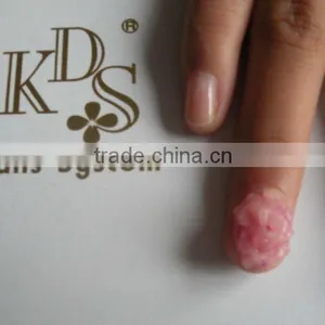 Plastic Nail Polish Remover Bottle Packed or Soft Tube Remover thumbnail-1